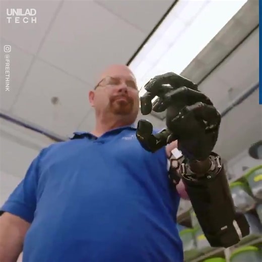 3.3K views · 118 reactions | Thought-controlled bionic arm by UNILAD Tech #MI #Robotics #Healthcare #HealthTech #EmergingTech #Technology | 2045 Initiative | Facebook
