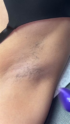 Effective Underarm Waxing with Aurora Wax Techniques