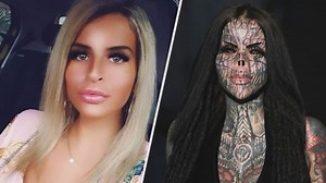 Um auszusehen wie ein Cyborg: Bielefelderin lässt sich Hörner implantieren