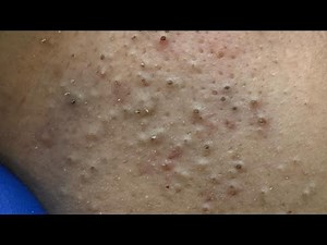 The Ultimate Facial Care Routine: Deep Cleansing Techniques For Clear Skin