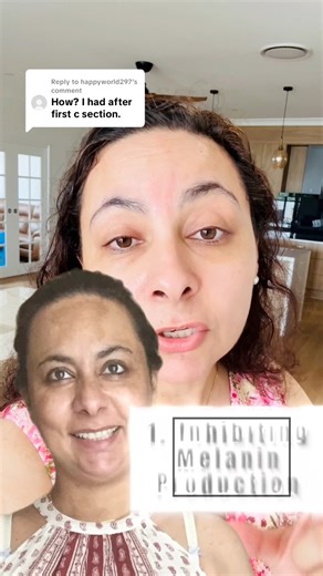 Replying to @happyword297 . Sustainable Melasma Removal: Inhibiting Melanin Production and minimizing triggers #drinderpreetk #canadapunjabi #ukwale #punjabisincanada #usawale | Dr. Inder Preet Kaur