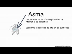 Asthma Spanish
