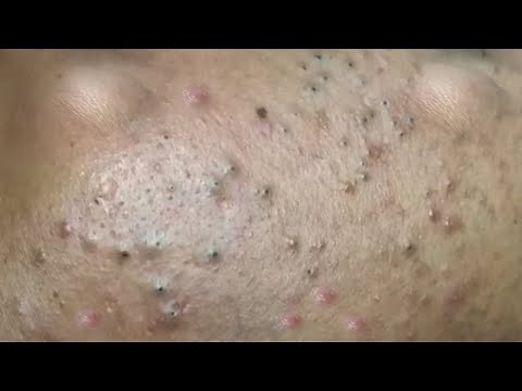 Satisfying Relaxing with Best Video 2021 Windy Spa #025