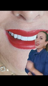 Ya conocías esta técnica tan noble para diseño de sonrisa? 👉👄👈 ✅Carillas con técnica de inyección ✅Citas whatsapp 6861613929 Dra. Sonrisas🦷👄👩‍⚕️ | Dentista Mexicali/ Dra. Sonrisas
