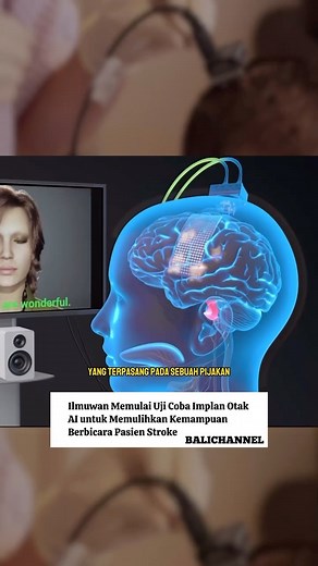 2.1K views | Implan otak yang ditenagai oleh kecerdasan buatan (AI)...