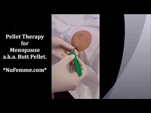 Watch a Hormone Pellet Insertion Procedure ~ Pellet Therapy for Menopause