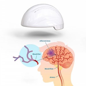 [Hot Item] Neurotechnology 810nm Infrared LED Light Brain Photobiomodulation Helmet