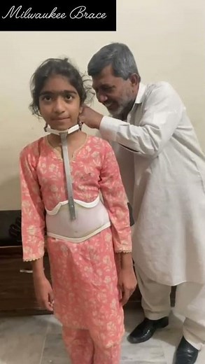 Milwaukee Brace | Scoliosis Brace | Flexible Scoliosis Brace | Scoliosis Disease | Brace | Boston