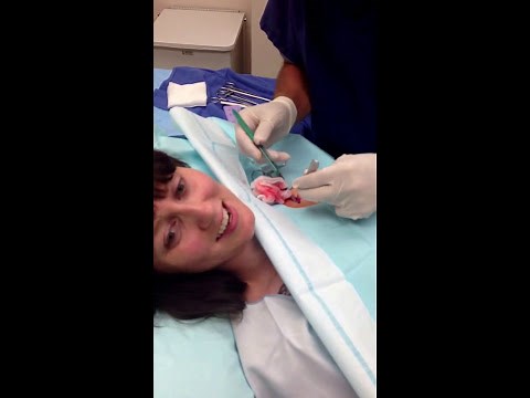 Chemo Port removal