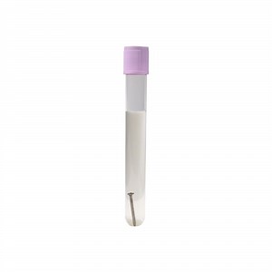 [Hot Item] Siny 10ml Srb Test Tube Detection Sulfate Reducing Bacteria