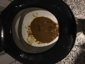 diarrhea at home 09/16/2017