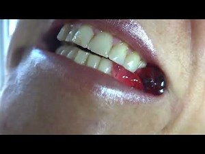 Woman Biting Hard