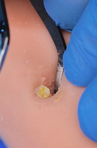 1.1M views · 5.5K reactions | Professional-Grade Callus Removal | 5-Minute Crafts SHORTS | Facebook