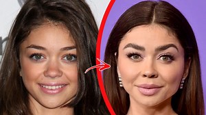 5 Botched Celebrities Who Became Unrecognizable | Beyond The Screen