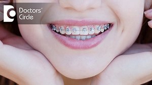 2K views · 16 reactions | How to close the gap between upper & lower front teeth? | Doctors' Circle | Facebook