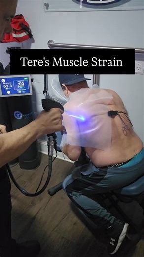 .....Teres major muscle pain can manifest as a sharp pain in the shoulder, upper arm, or axilla, often exacerbated by physical activity or movements that involve the hand being placed behind the back. Tears of the teres major, though rare, can cause sudden onset pain. Additionally, pain can radiate to the front and side of the shoulder and down the back of the arm #CryotherapyRevolution #NextLevelCold #PrecisionMatters #InflammationDestroyer #MedicalElite #CO2Supremacy #EngineeredForGreatness #N