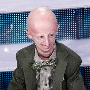 608K views · 3.4K shares | Ha 21 anni, ma è imprigionato nel corpo di un anziano. Sammy è uno dei 5 malati di progeria in Italia. Lui rischia la vita ogni giorno, ma il suo coraggio è un esempio per tutti. | Fanpage.it | Facebook