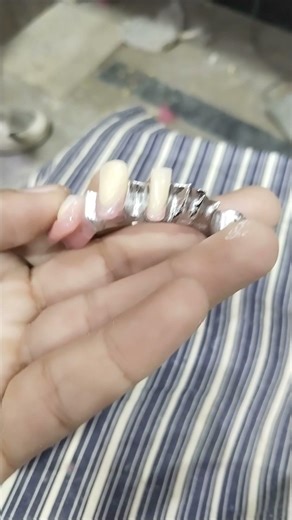 Lower Removable Cost Partial Denture 😁😁😁#partialdenture #cost #rpddentalprocedure