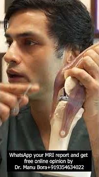 ACL Tear? Know the Right Time for Surgery || #aclrehab #acltear