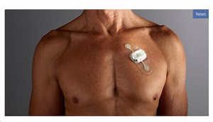 iRhythm Technologies, Inc. :  Transforming Cardiac Diagnostics  via AI
