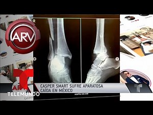 Casper Smart tuvo un cumpleaños accidentado | Al Rojo Vivo | Telemundo