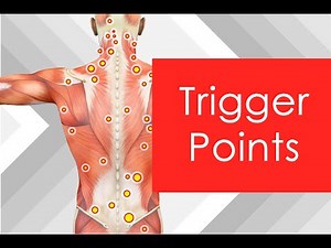 What is a muscle Trigger Point !