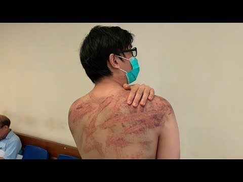 Hong Kong triad attack victim recounts ordeal