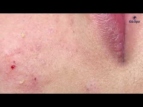 FULL BLACKHEAD | 21.04.2021