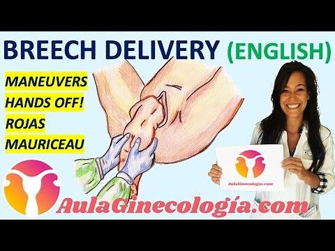 BREECH DELIVERY MANEUVERS: HANDS OFF, ROJAS, MAURICEAU... BASIC RULES. - Gynecology and Obstetrics -