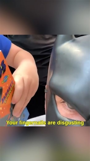 Those fingernails 😬 | Batdad