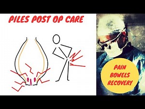 Piles post op care | Hemorrhoid Surgery instructions | Hemorrhoidectomy Advice