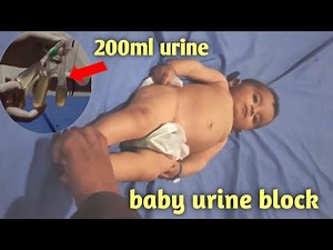 pass urine catheter, baby urinary retention, catheterization,