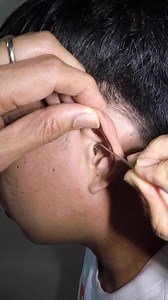 Got it! #earwaxremoval #earwaxremovalvideos #earcleaning #fyp #earcare | ear curation