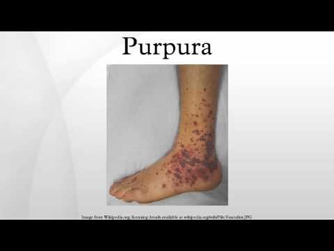 Purpura