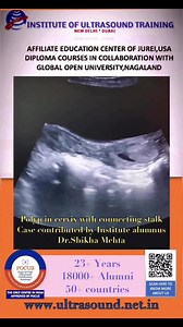 2.2K views · 37 reactions | #cervixpolyp #ultrasound #drrandhawainstitute #onlineultrasoundcourses #UltrasoundTraining #obgyn #ObgynUltrasound | Dr.Randhawa’s Institute of Ultrasound Training ,Delhi -Affiliate Jurei,USA | Facebook