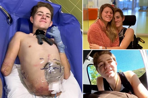 I lost half my body in a forklift accident — stop asking how I have sex