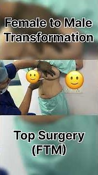 “Before & After Top Surgery | Real Sex Change Transformation Story”
