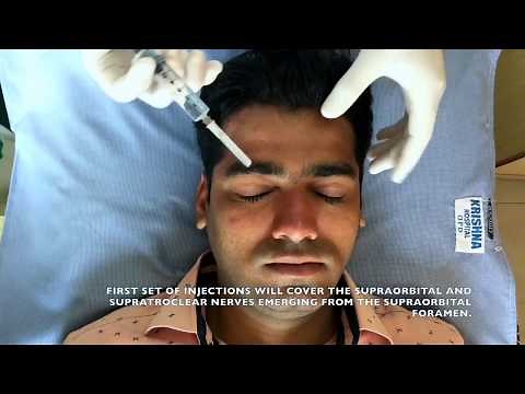 Regional Nerve Block for Scalp - Local Anaesthesia for PRP & other scalp procedures.