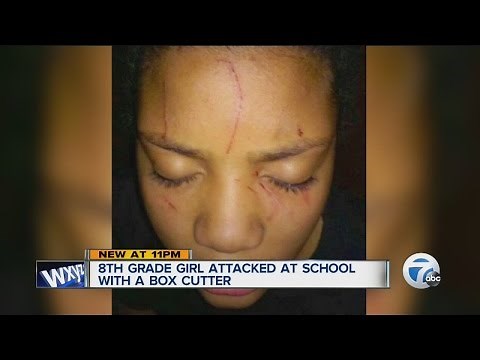 8th grade girl's face slashed with a box cutter