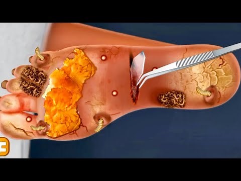 Medical Game - Foot Doctor: Fun & Challenging Foot Surgery!🦶🩸✂️🩺