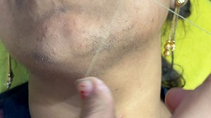 22K views · 151 reactions | Face hard hair growth threading /Facial hair removal tutorial/ #facethreading ​⁠#wax Pummy Beauty World | Pummy Beauty World | Facebook