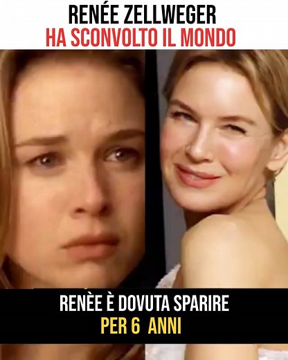 226K views · 902 reactions | Il ritorno di Renée Zellweger nel 2014 ha sconvolto il mondo… | Paradigm Italia | Facebook