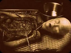 Russian Alien Autopsy/ Moscow 1972 UFOKRASH (KGB X-Files) 35 mm film original footage