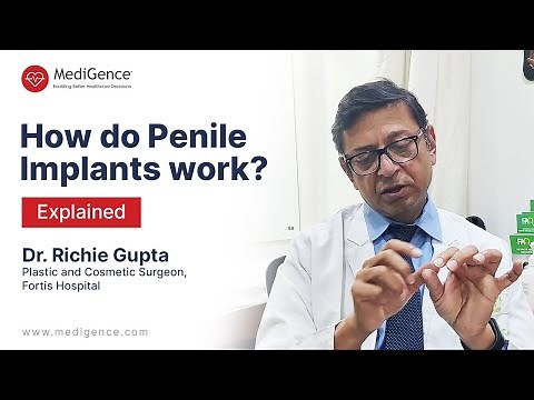 How do Penile Implants work? Explained by Dr. Richie Gupta