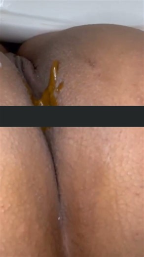 South American woman shitting hot liquid 12