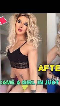 Male to Female 10 Months HRT Transition | Male to Female Transition | MTF Transition Timeline