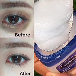 378K views · 1.8K reactions | Mix Vaseline With Honey ~ the secret nobody will ever tell you ~ thank me later ! #antiaging #darkcircles # | Anmol Hindi | Facebook