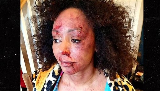 Is it Her Reality? Mel B is Bruised, Bloodied, Battered and Trapped in Domestic Abuse Film / WATCH | EURweb | Black News, Culture, Entertainment & More
