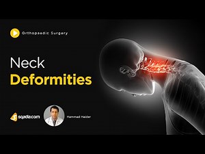 Neck Deformities | Orthopaedic Surgery Lectures | Clinical Education | V-Learning
