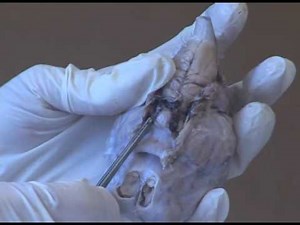 How to Teach: Teasing Apart a Sheep's Brain